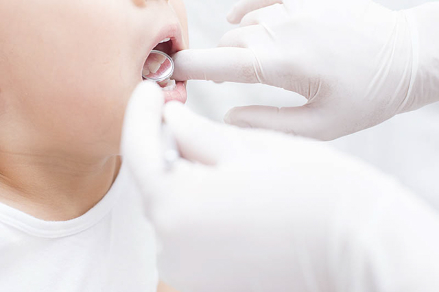 歯周病メインテナンス